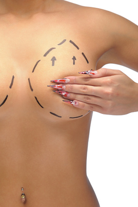 Fat Grafting for Breast Augmentation