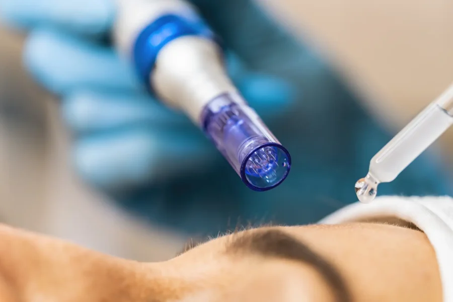 Top 3 Non-Surgical Skin Treatments for Skin Rejuvenation