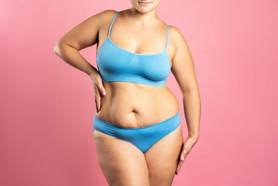 Liposuction & Fat Grafting 640470954fbea