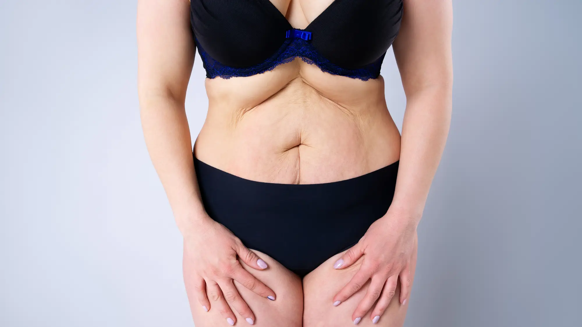 Liposuction vs. Tummy Tuck: Which One Is Right for You?
